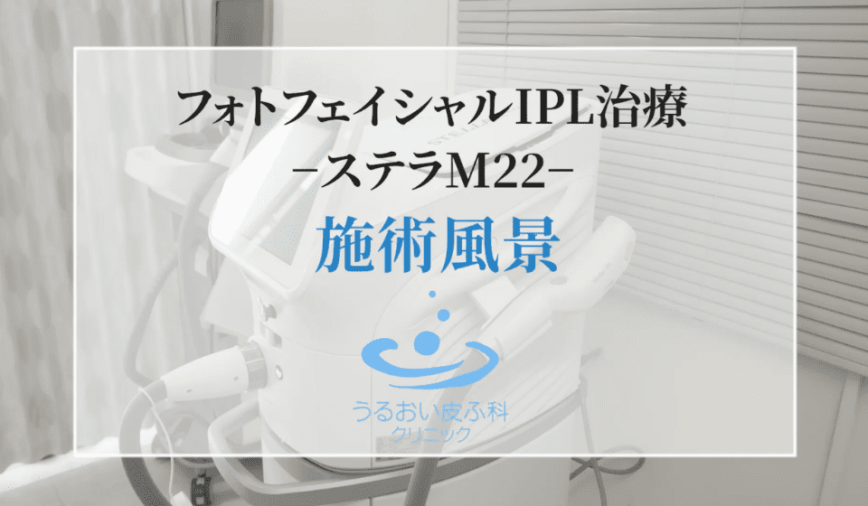 IPL治療の施術動画 2を再生
